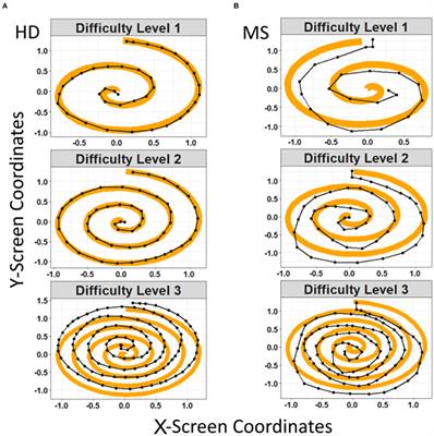 Assessment of Smartphone-Based Spiral Tracing in Multiple Sclerosis Reveals Intra-Individual Reproducibility as a Major Determinant of the Clinical Utility of the Digital Test